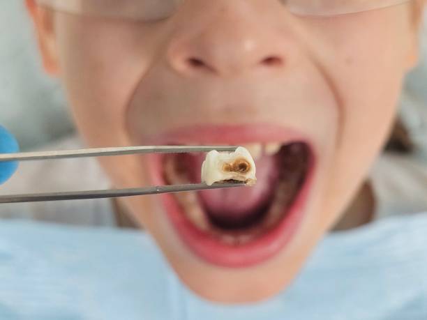 Best Emergency Tooth Extraction  in Lumberton, NC